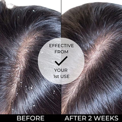 Dahi Shampoo for Anti Dandruff | With Panchamrit (Milk, Honey, Sugar, Curd, Ghee) | No sulphate & Parabens Hair Shampoo (300ml)